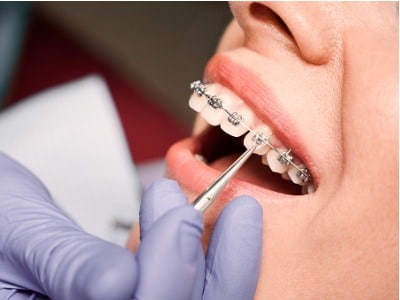 Dental Implants In Garland
