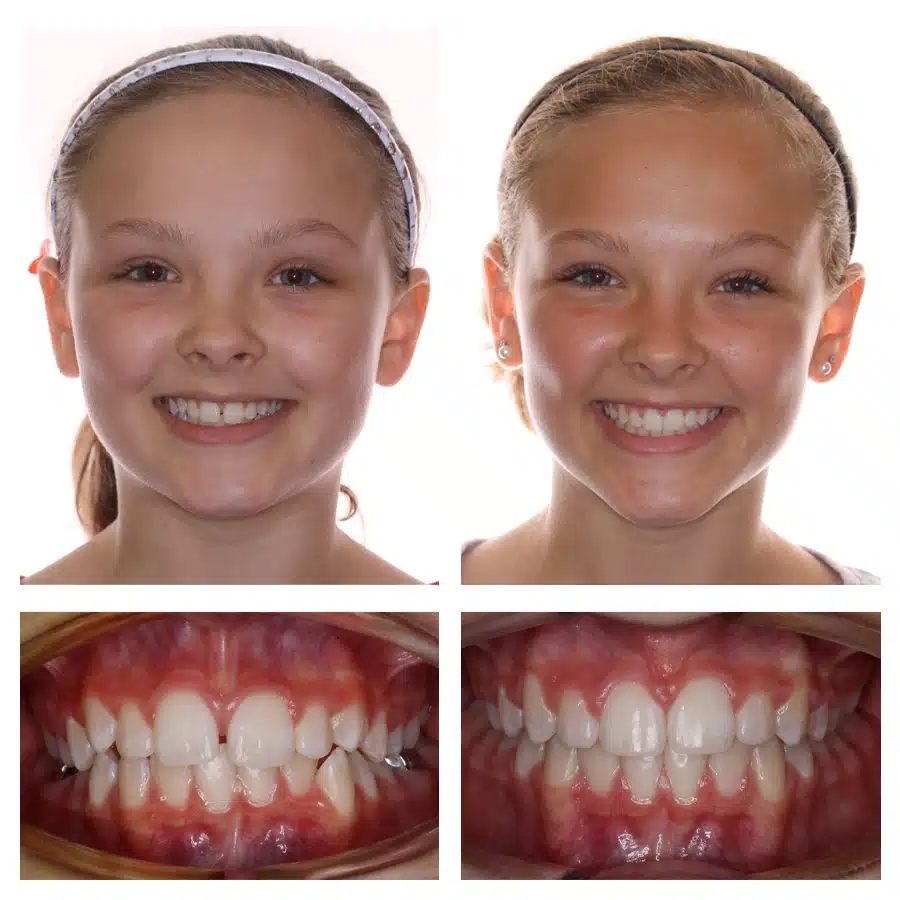 Ashley Lesser Before and After