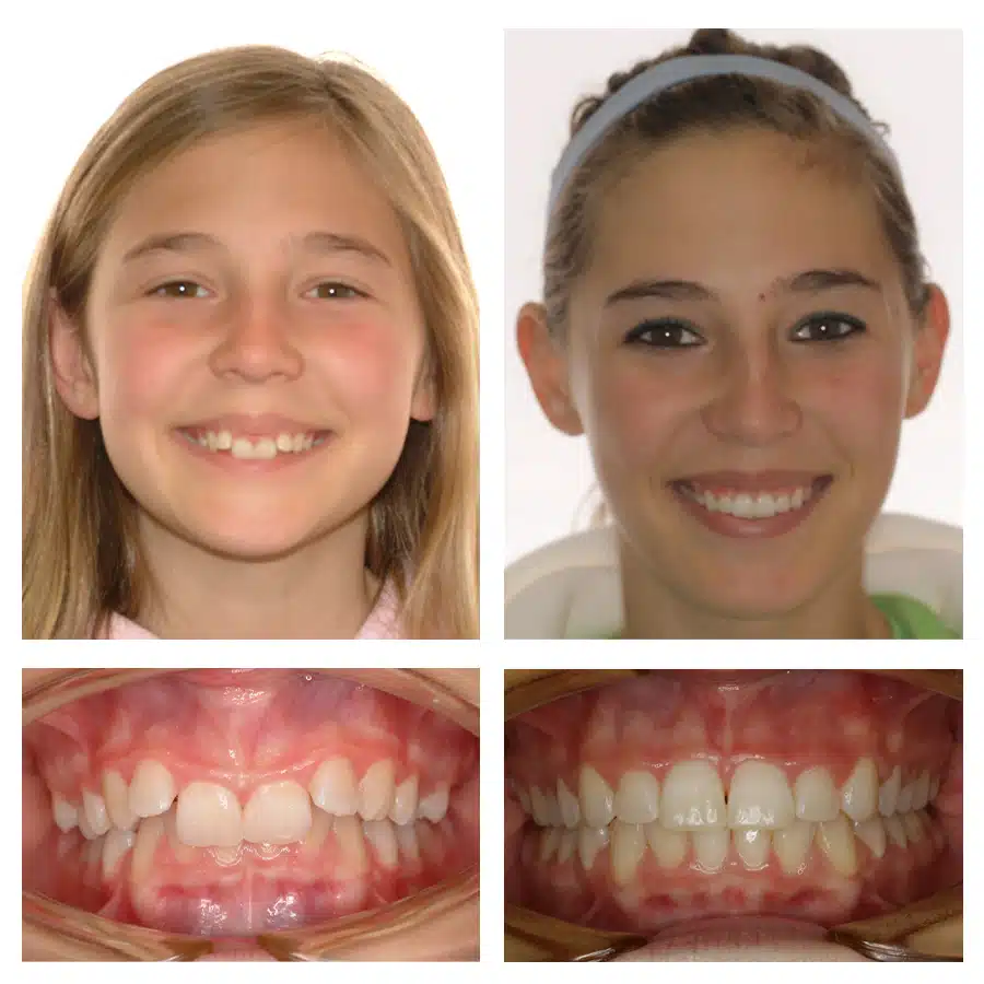Elizabeth Lawler Before and After