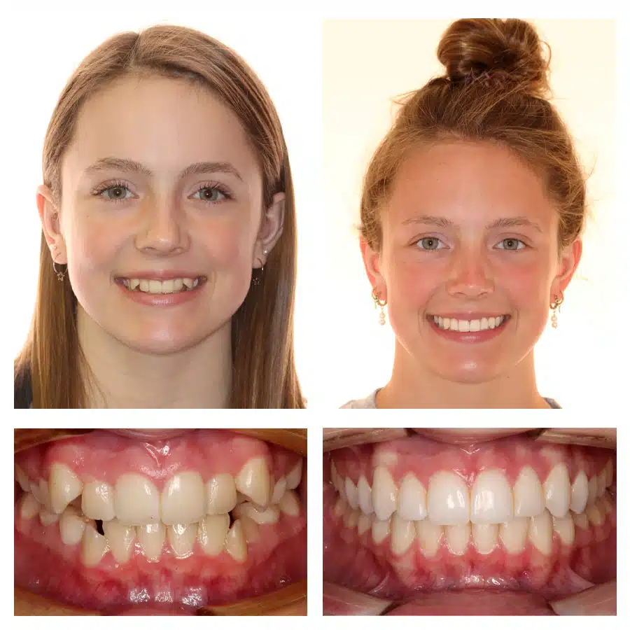 Maggie Wanezek Before and After