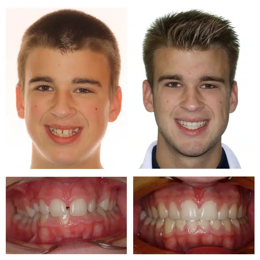 Max Prospero Before and After
